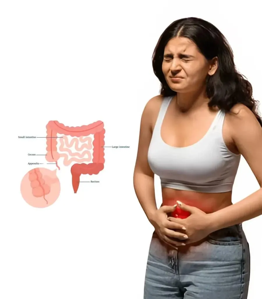 Laparoscopic appendectomy at Lux Hospitals, HITEC CITY, Hyderabad.
