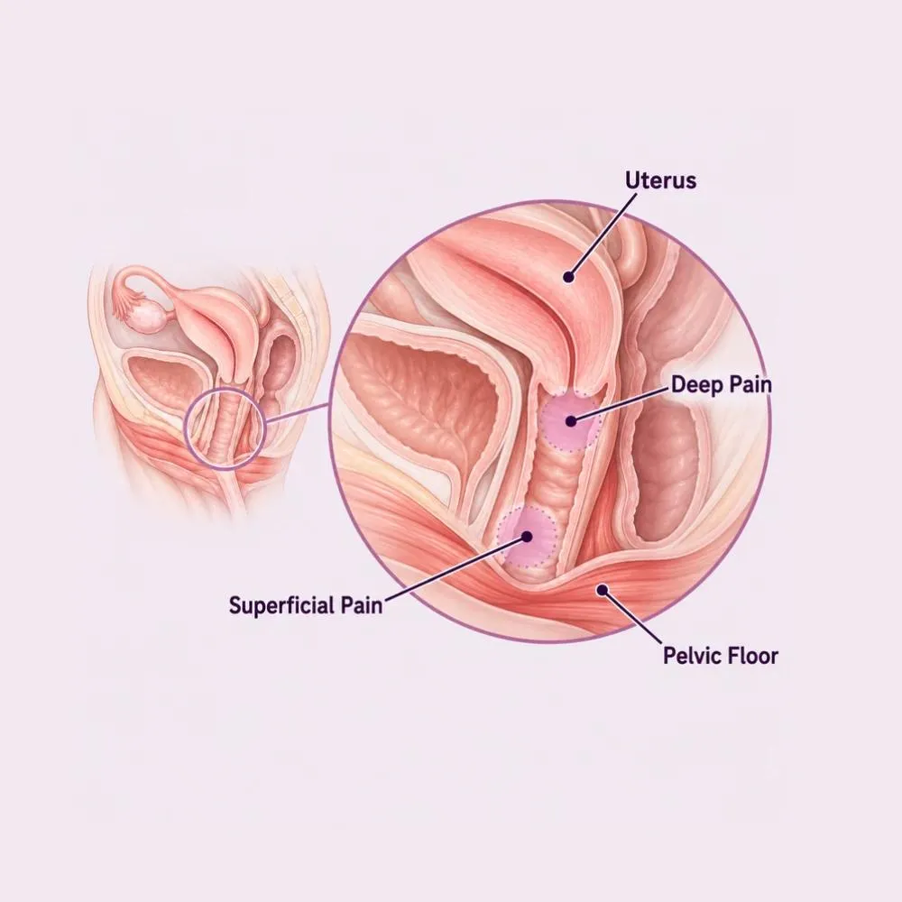 Labelled medical illustration of Dyspareunia
