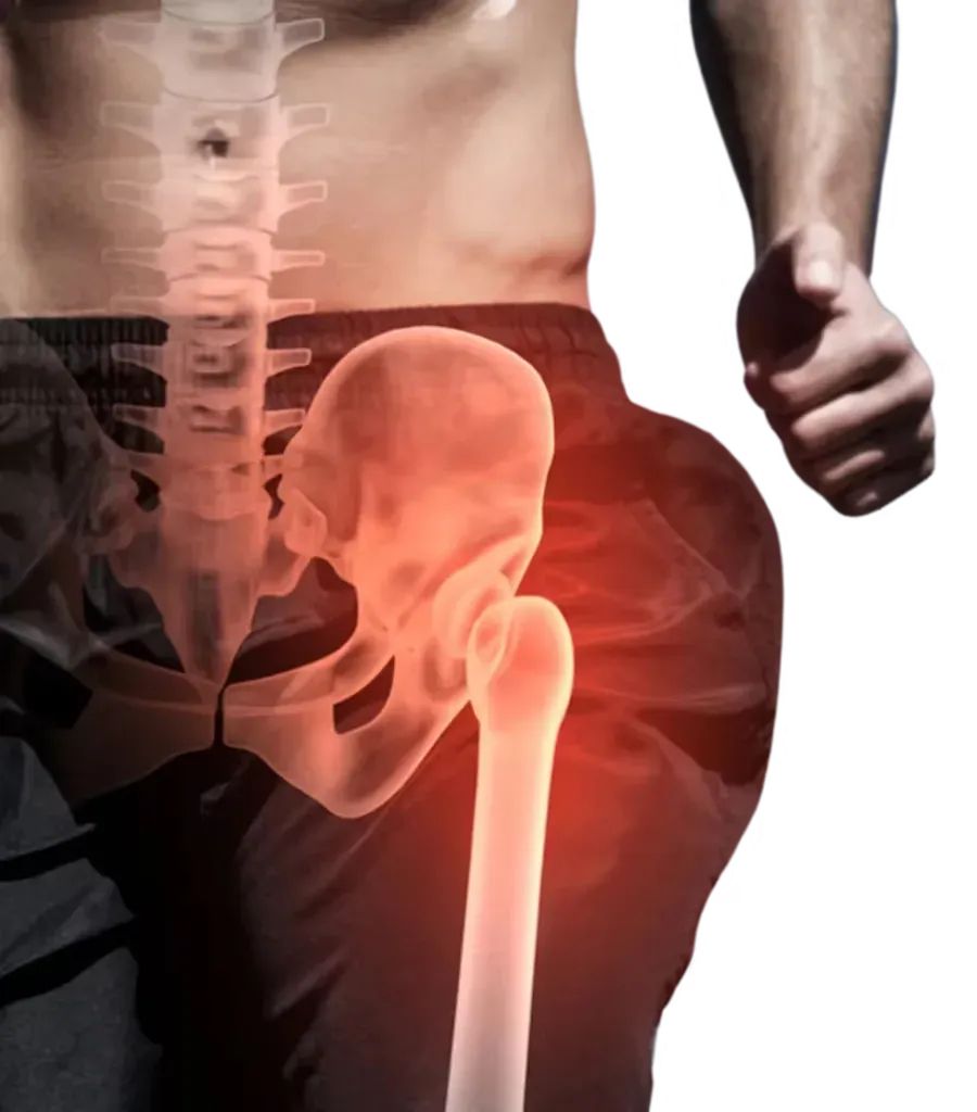 ACL Surgery at Lux Hospitals, Hyderabad