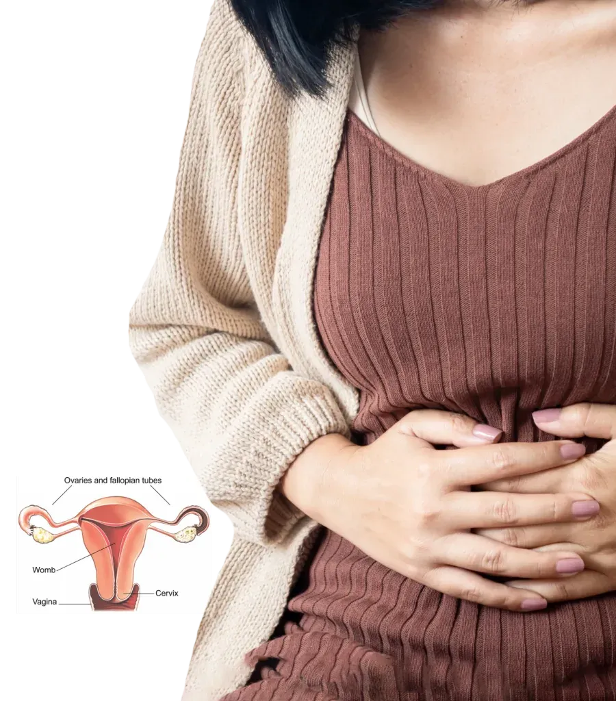 Laparoscopic hysterectomy at Lux Hospitals, HITEC CITY, Hyderabad.