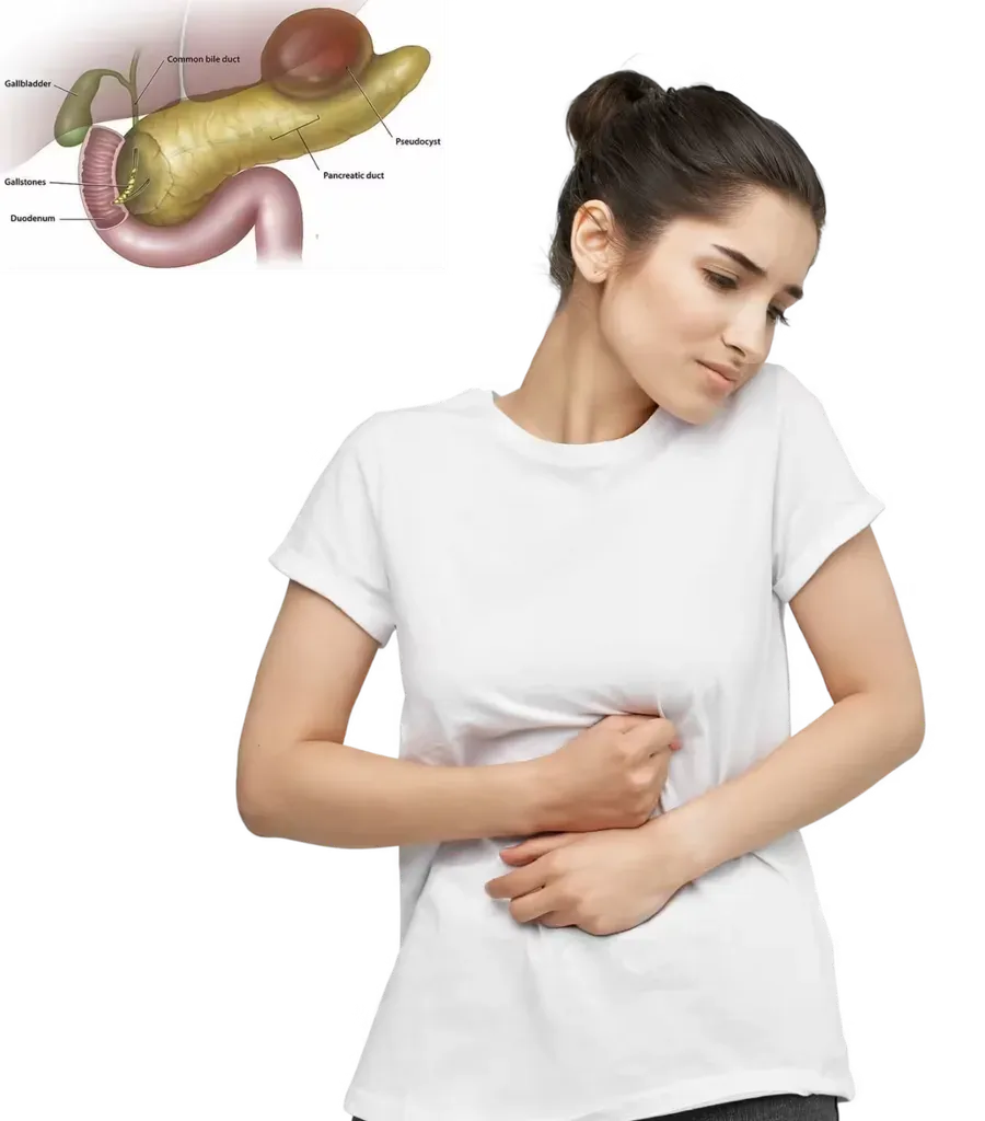 Pancreatic pseudocyst drainage at Lux Hospitals, HITEC CITY, Hyderabad.