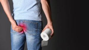 External Hemorrhoids Treatment