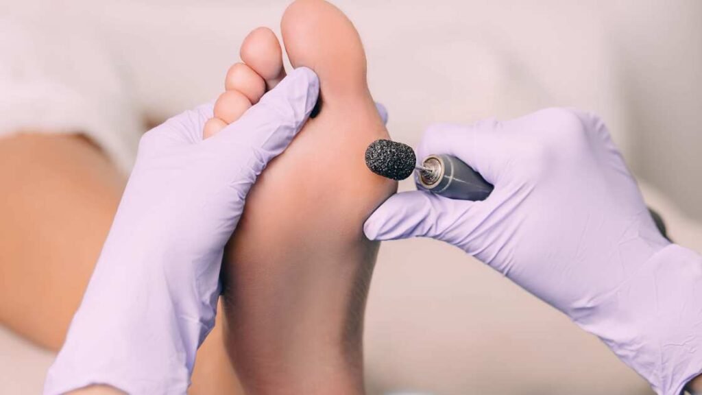 Effective Foot Corn Medical Treatment: Advanced Solutions for Relief