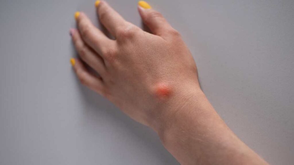 8 Types of Cysts You Need to Know About