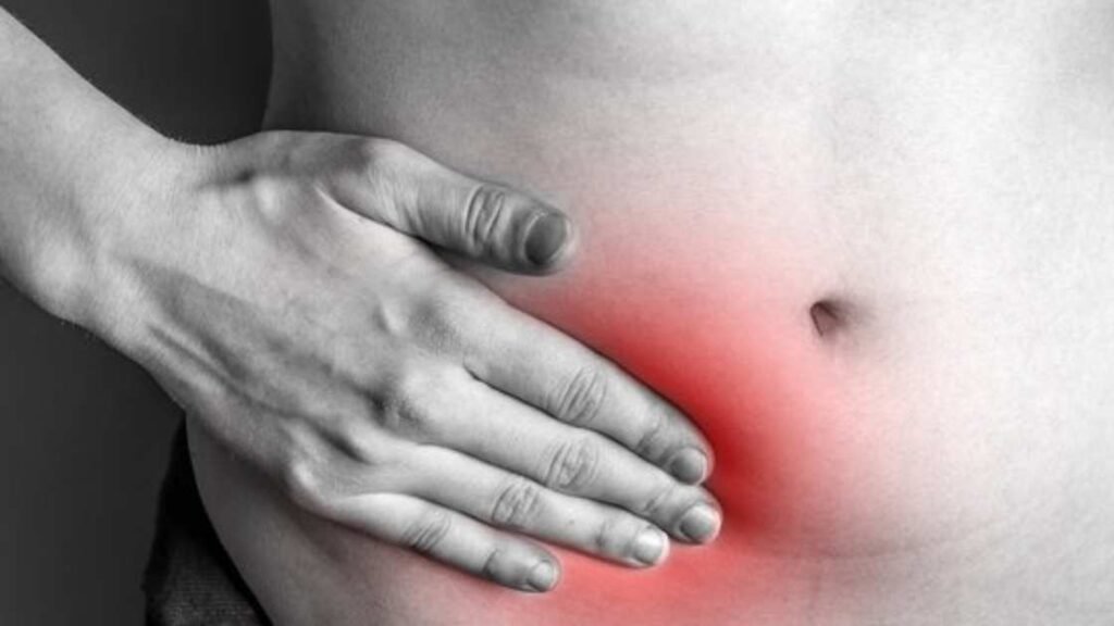 How to Reduce the Risk of a Hernia: 10 Essential Strategies for Prevention