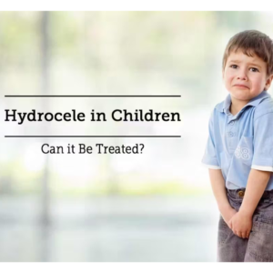 hydrocele in children