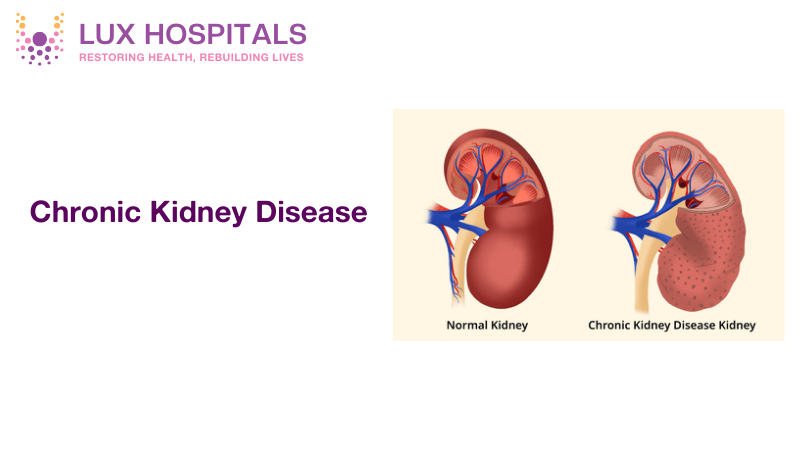 How to Manage Chronic Kidney Disease: Tips for Maintaining Kidney Health