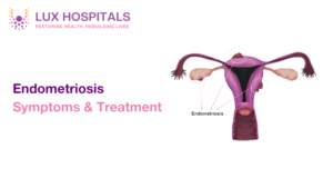 Endometriosis Treatment Options