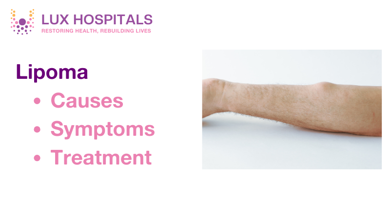 Lipoma Risks and Causes