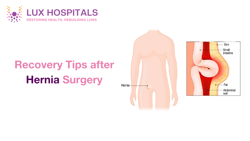 HERNIA SURGERY RECOVERY TIPS FOR A SMOOTH HEALING PROCESS