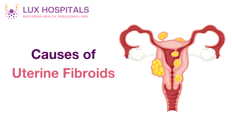 Understanding the Causes of Uterine Fibroids: What You Should Know