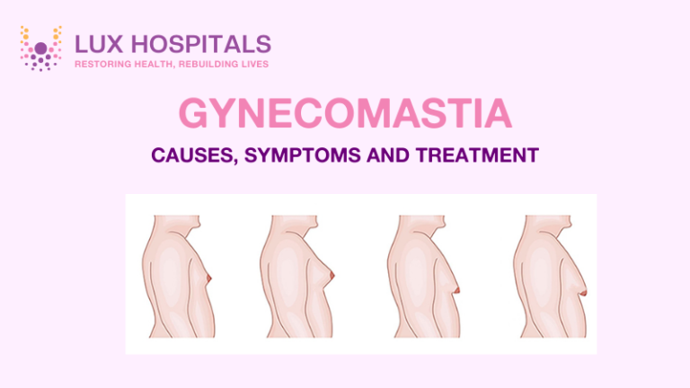 Gynecomastia