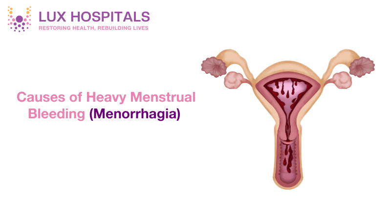 Heavy Menstrual Bleeding