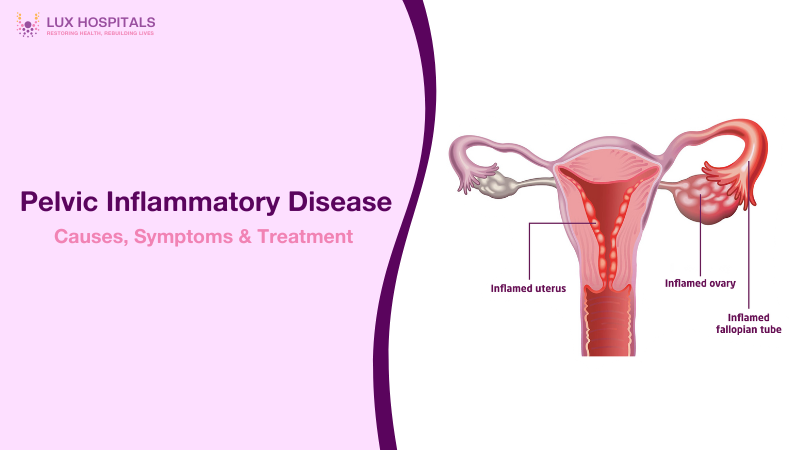 Pelvic Inflammatory Disease