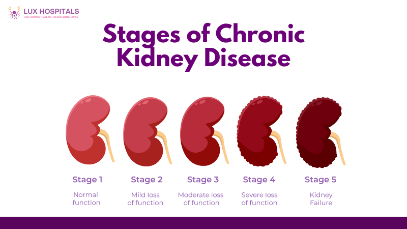 Stages of Chronic Kidney Diseases