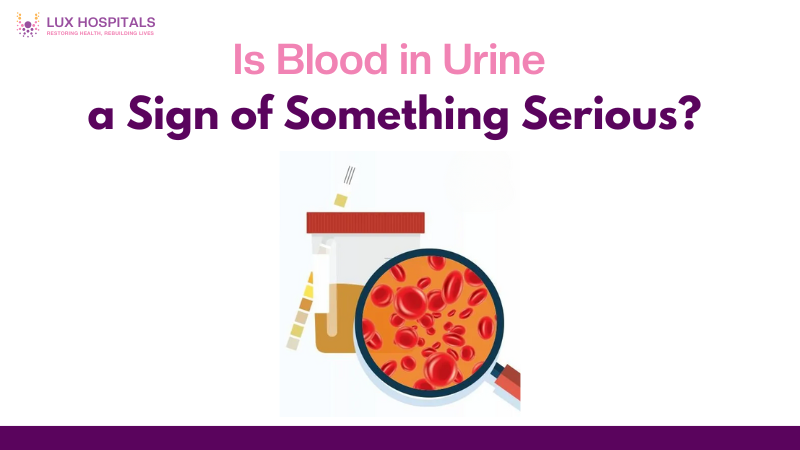 Blood in urine