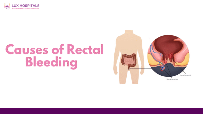 Causes of Rectal Bleeding