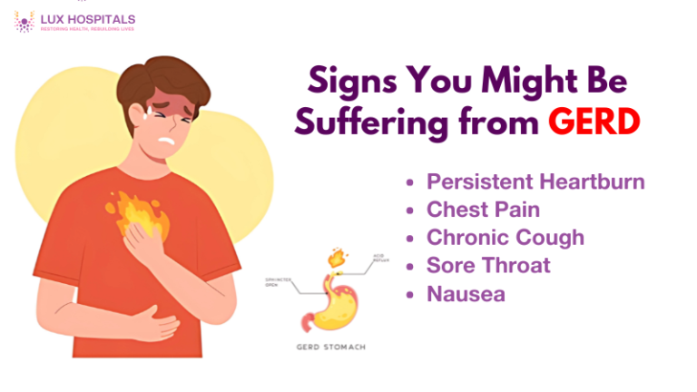 GERD signs and symptoms