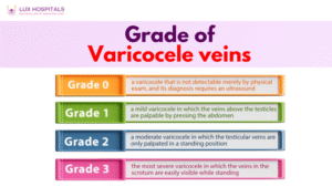 Varicocele Veins Grading