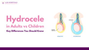 Hydrocele in Adults vs Children