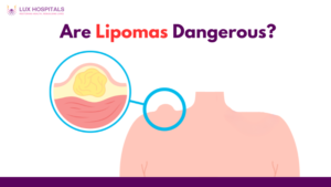 Are Lipomas Dangerous