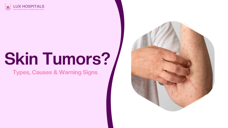 Understanding Skin Tumors: Types, Causes & Warning Signs