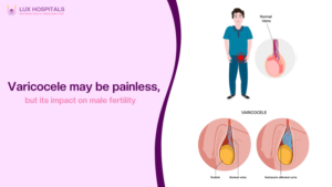 varicocele veins affect male fertility