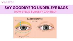 Under Eye Bags