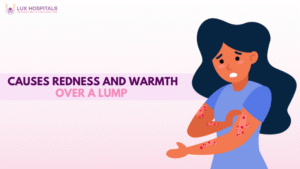 Causes Redness and Warmth Over a Lump