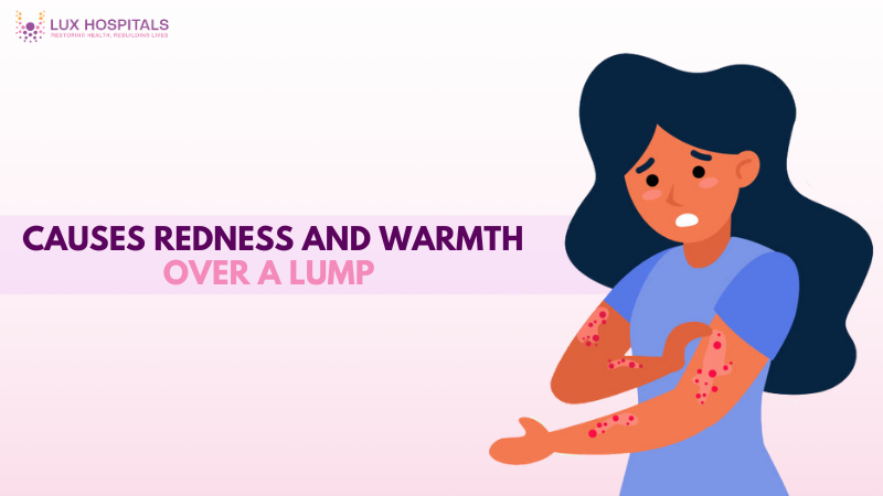 Causes Redness and Warmth Over a Lump