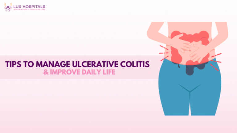 Ulcerative Colitis
