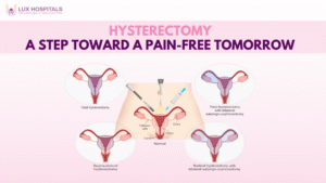 Hysterectomy