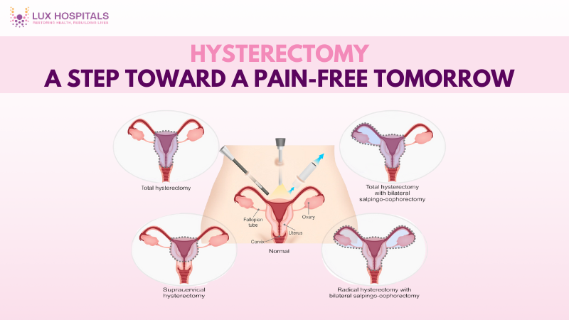 Hysterectomy