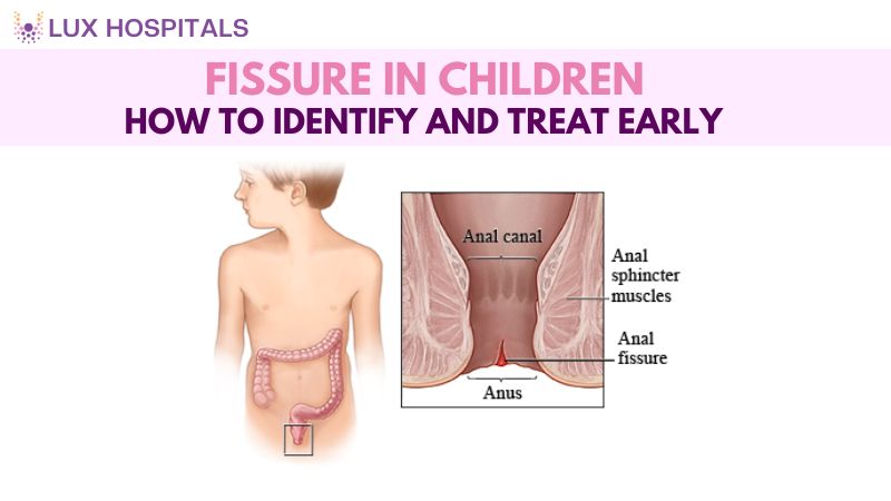 Fissures in Children: How to Identify and Treat Early. 