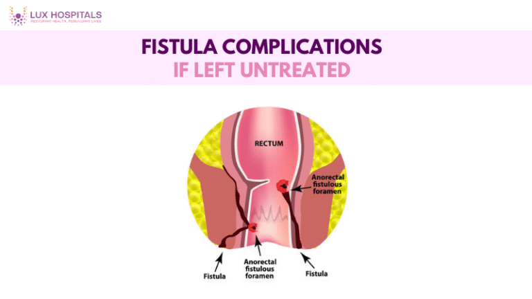 Fistula Complications if left untreated