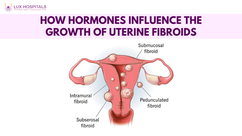 How Hormones Influence the Growth of Uterine Fibroids?