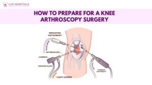 Knee arthroscopy