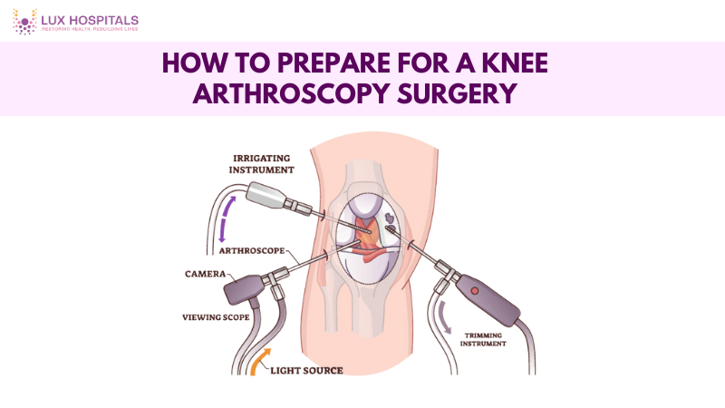 Knee arthroscopy