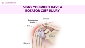Signs you might have a Rotator cuff