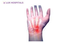 Right Doctor for Carpal Tunnel Syndrome