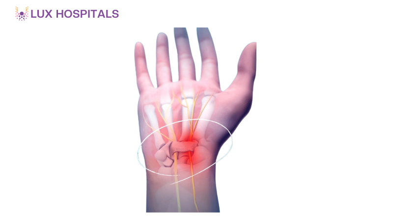 Choosing the Right Doctor for Carpal Tunnel Syndrome Treatment 