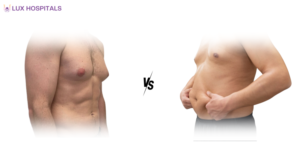 Obesity vs. True Gynecomastia: How Doctors Diagnose It