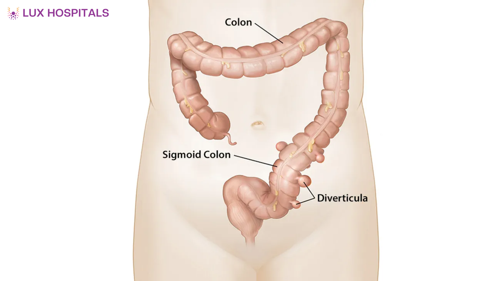 Top Gastroenterologists for Diverticulitis in Hyderabad