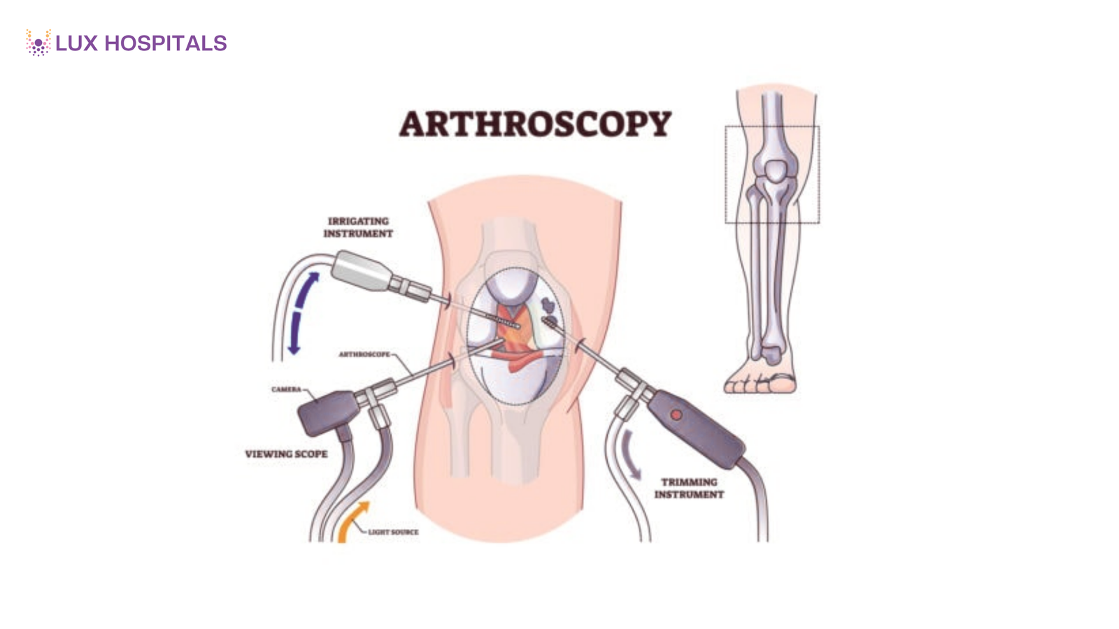 7 Signs You Might Need Arthroscopic Surgery