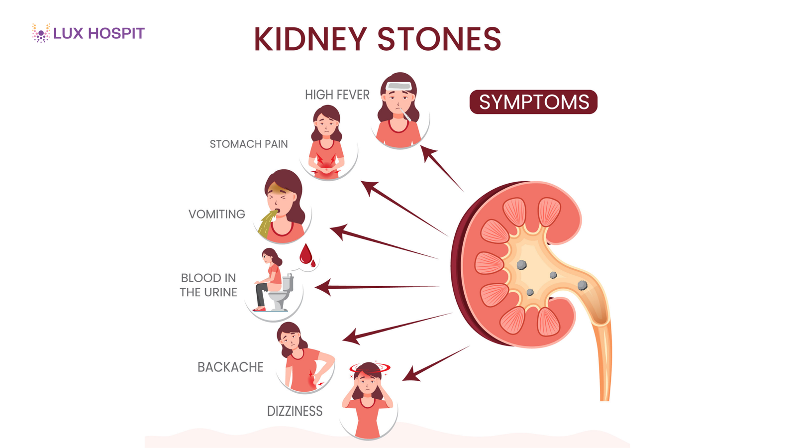 7 Signs You Need Immediate Kidney Stone Treatment