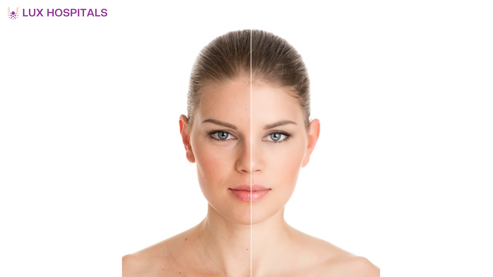 Best Treatment for Facial Rejuvenation