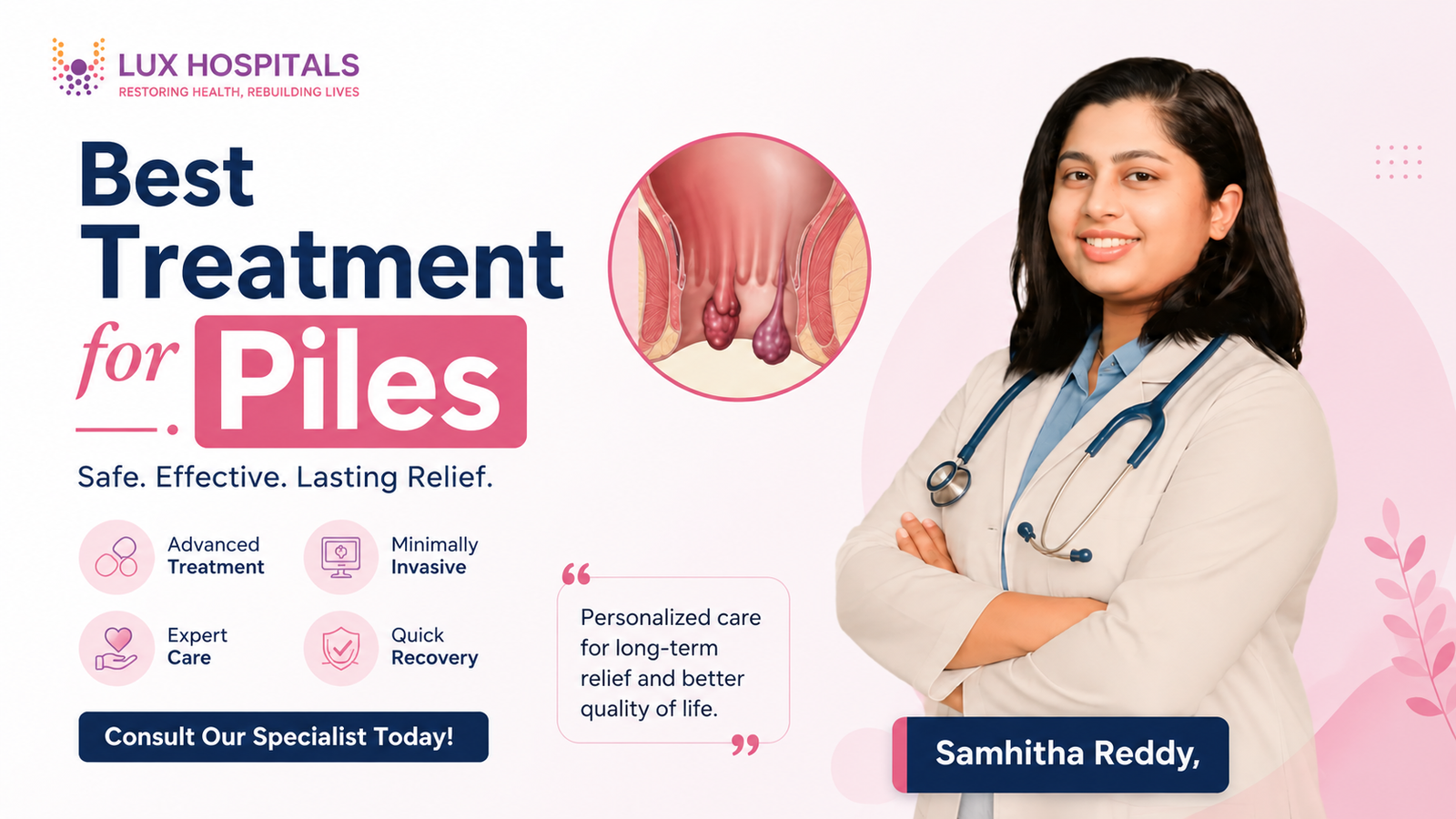 Which Treatment is Best for Piles? 