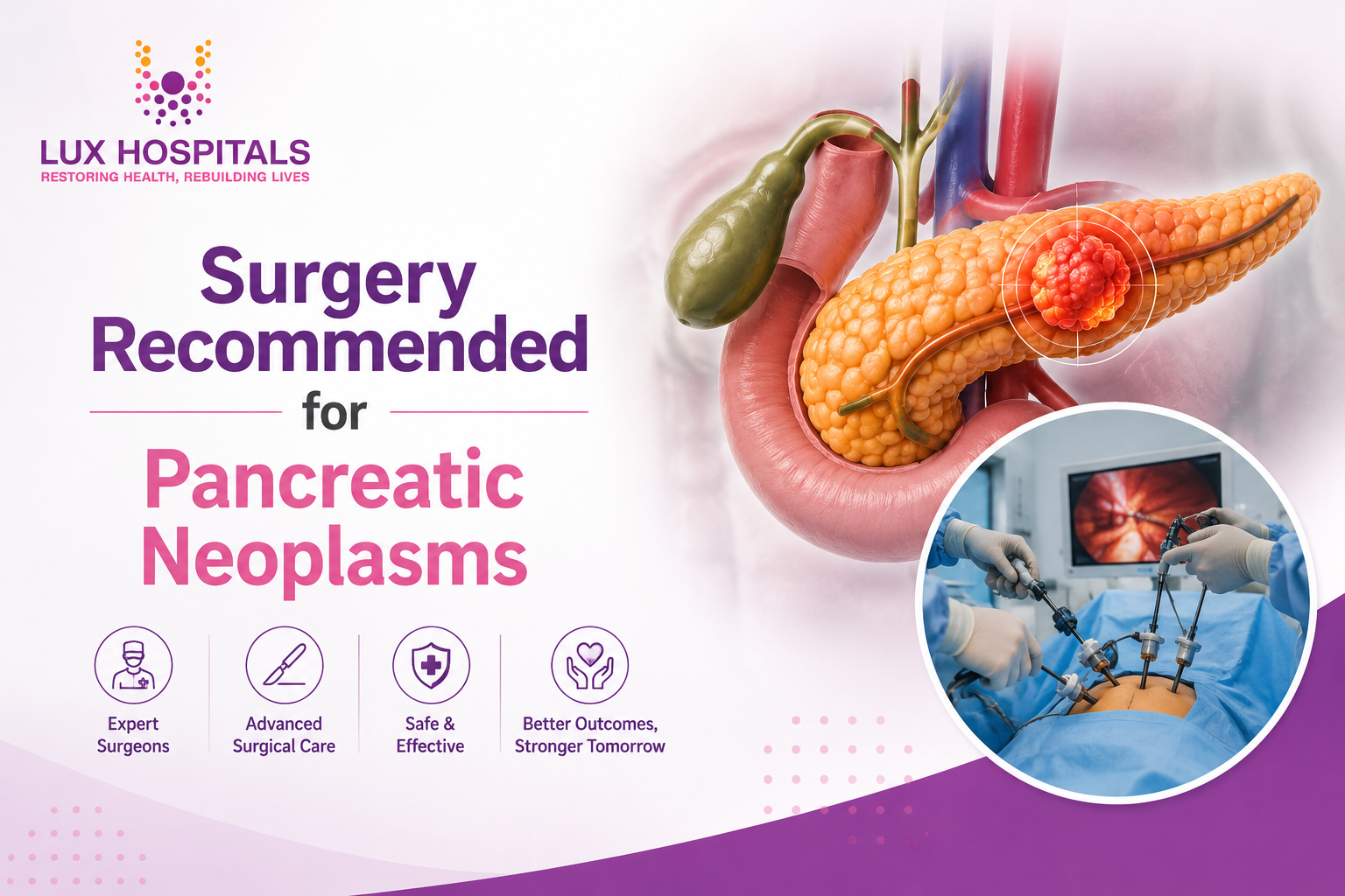 When Is Surgery Recommended for Pancreatic Neoplasms?