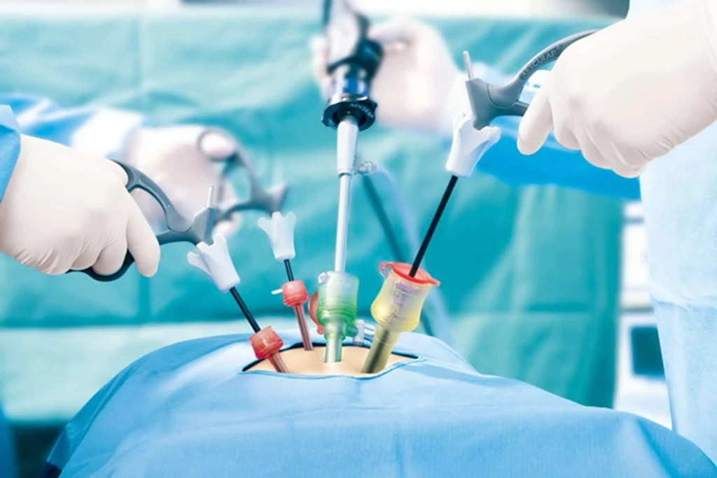 Minimally Invasive Excellence: Lux Hospitals' Laparoscopic Surgeries