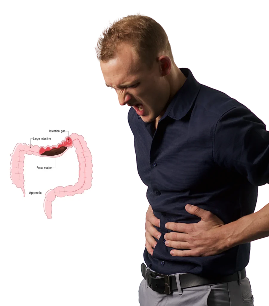Best Chronic Constipation Treatment in Hyderabad